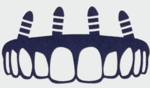 Link to Prosthodontics of Central Indiana home page